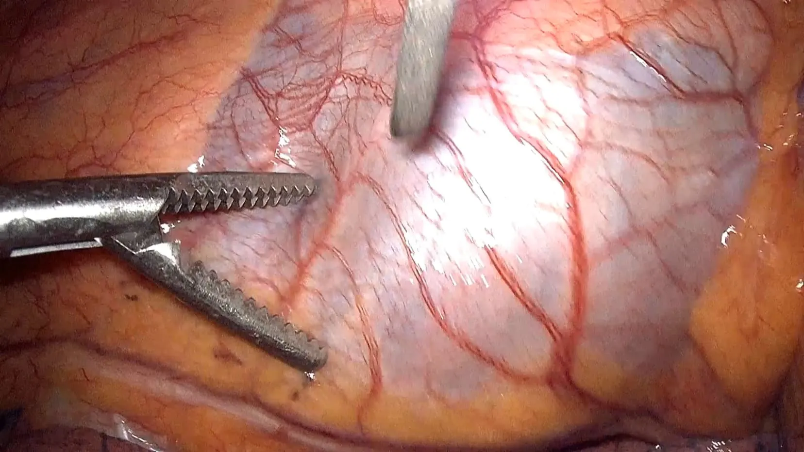 Unguided surgical view