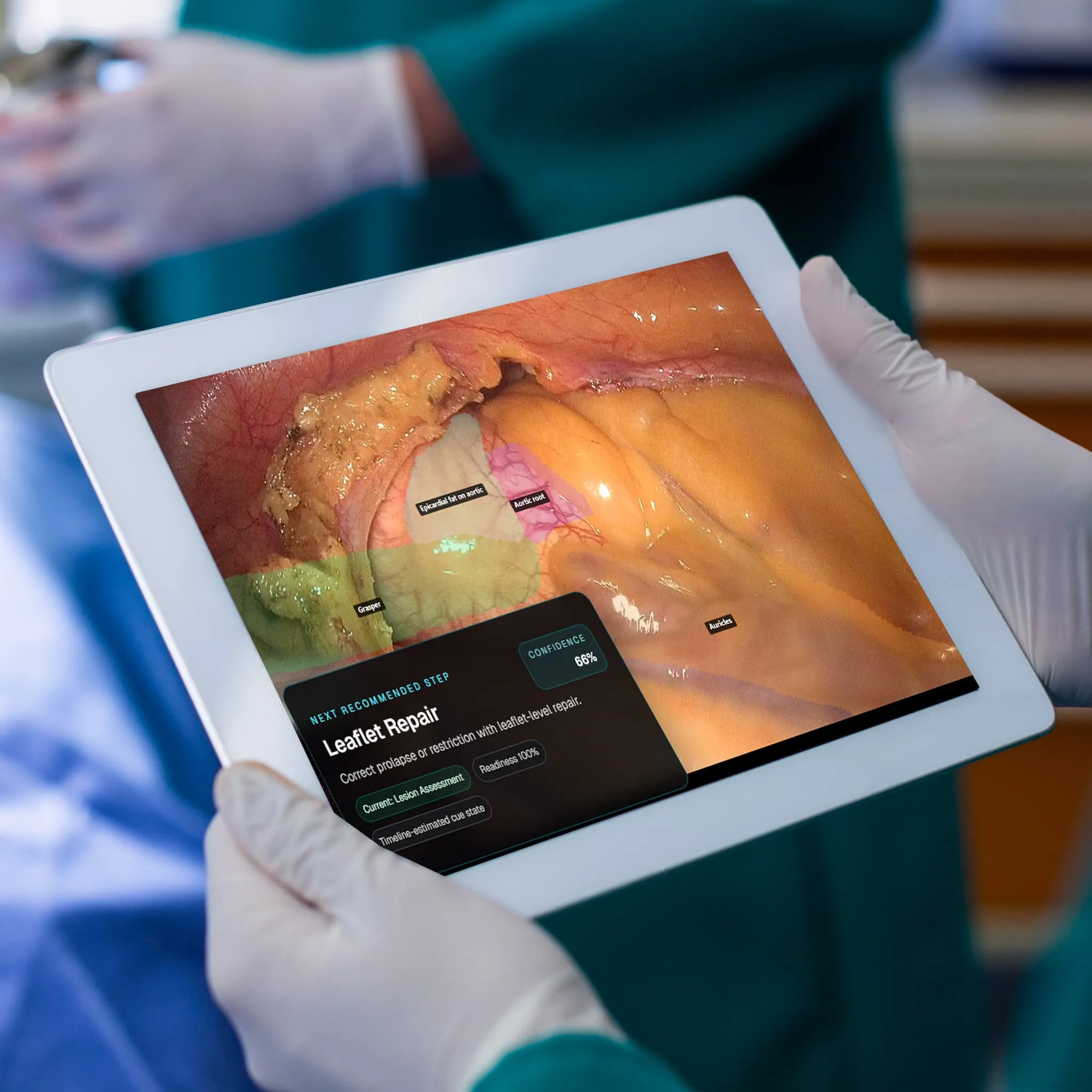 Intelligent Decision Support