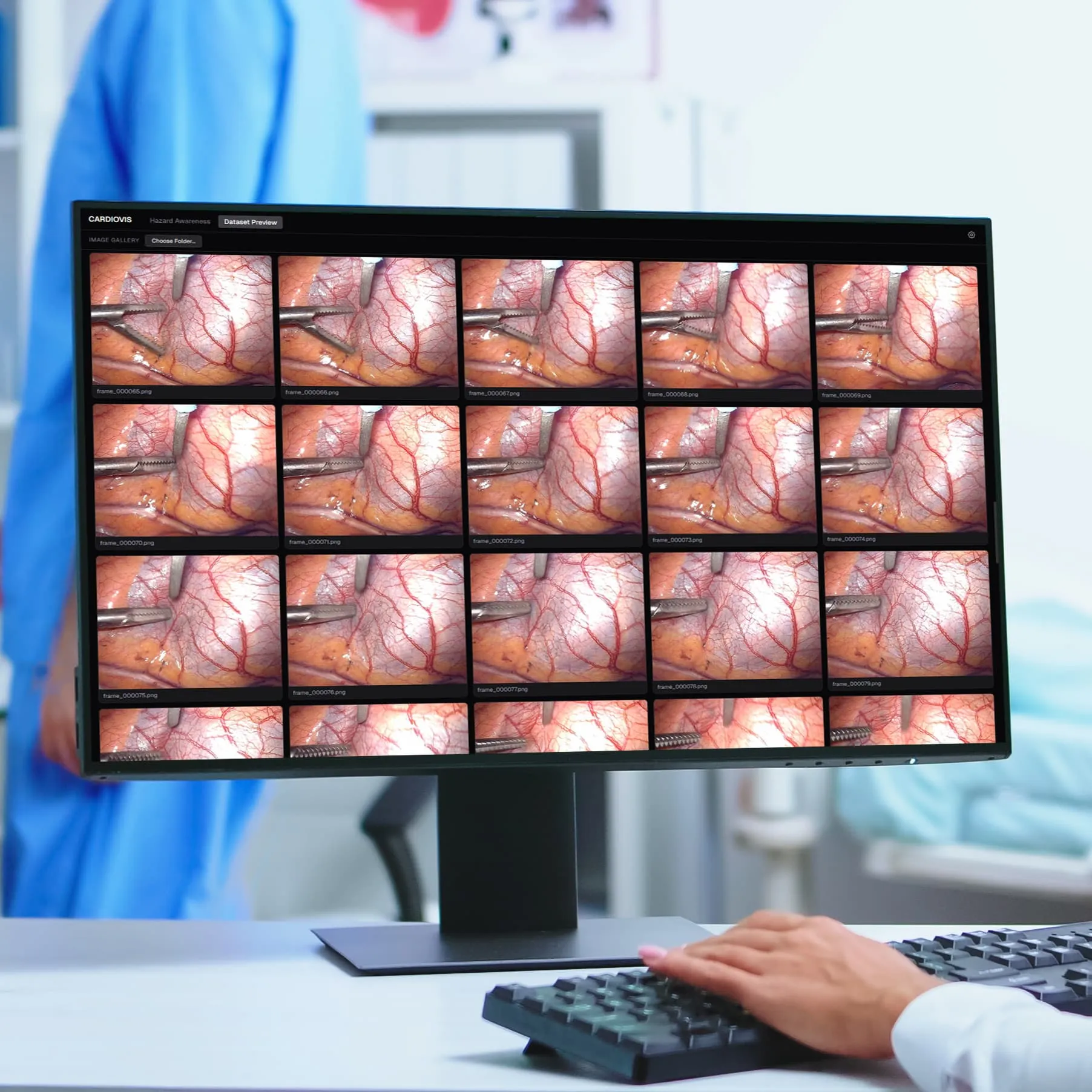 Learning Curve Compression